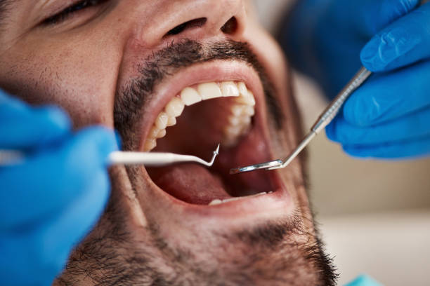 Best Emergency TMJ Treatment in Kennedy, CA