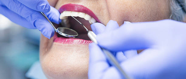 Best Emergency Tooth Extraction in Kennedy, CA