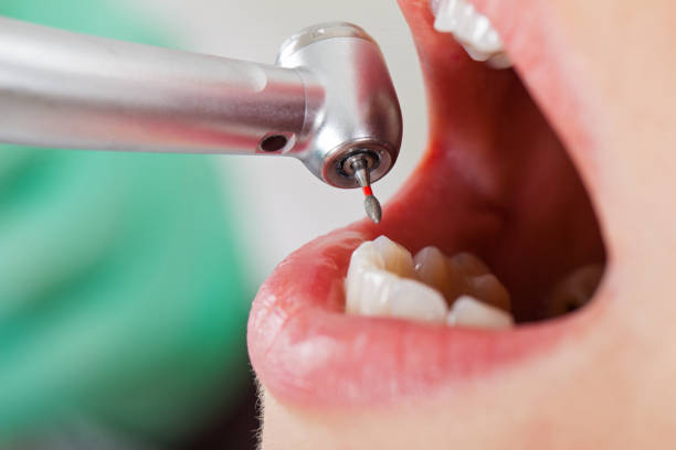 Best Weekend Emergency Dentist in Kennedy, CA